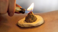 【艾灸知識(shí)】十大常見艾灸不良反應(yīng)，及處理方法！建議收藏！